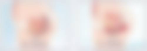 福州百纭凯曼整形美容诊所收费标准参考