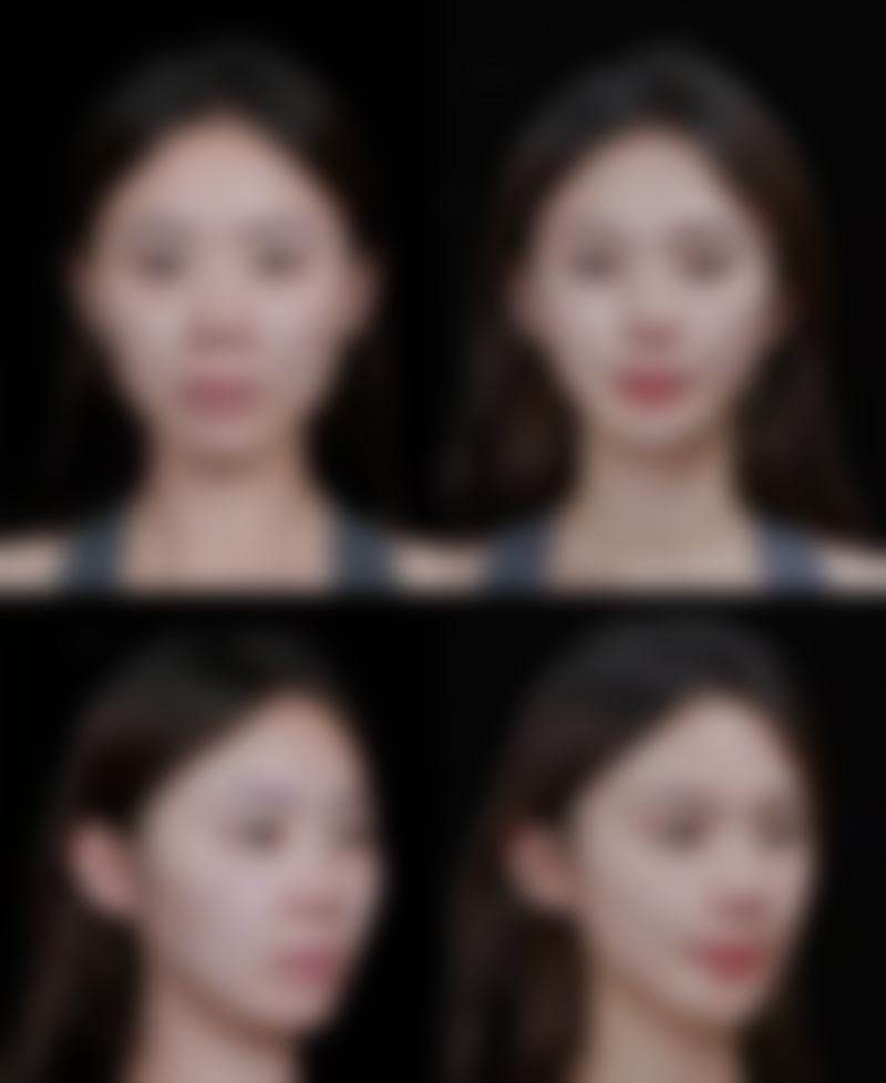 总结——福州百纭凯曼整形美容诊所怎么样?