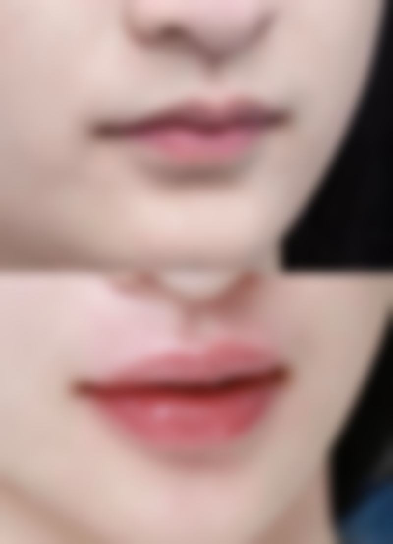 上海长宁天山中医医院整形美容科医院技术好不好?