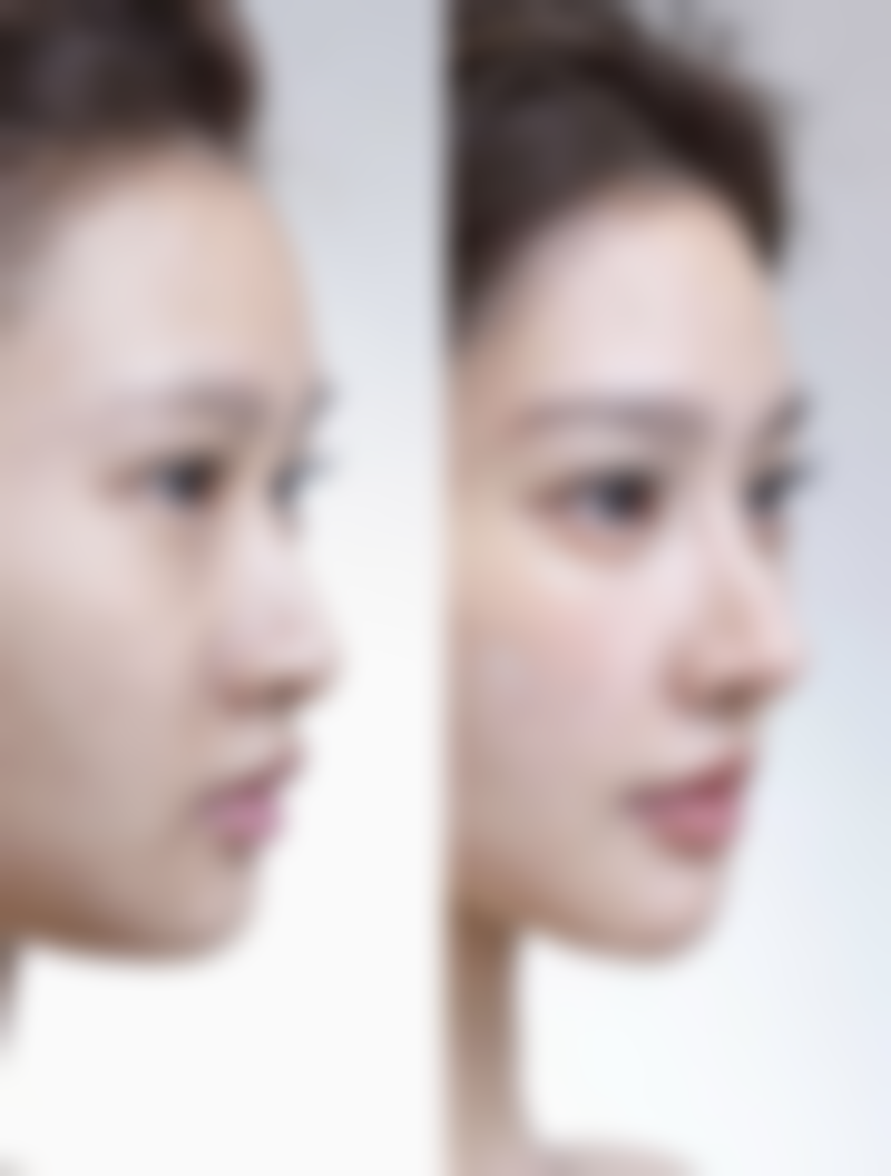 适合特定肤质的美白针品牌有哪些