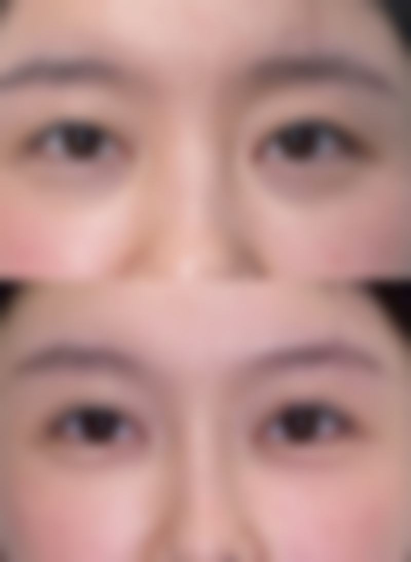 双眼皮吊顶是怎么吊法？从准备到验收，尺寸材料及注意事项全揭秘 