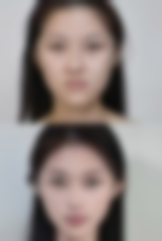 总结——宁德德尔美客医疗美容门诊部怎么样？