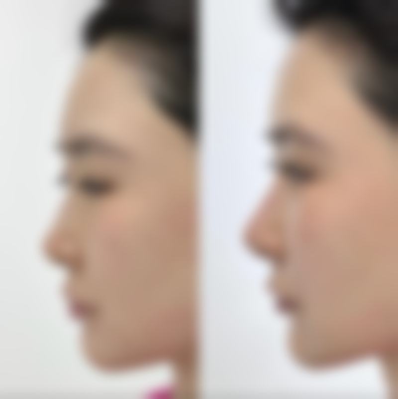 具有抗衰老功效的美白针品牌有哪些