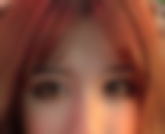 重庆松山医院医学美容科眼综合手术体验咋样？何军医生助我告别大小眼气质up！ 