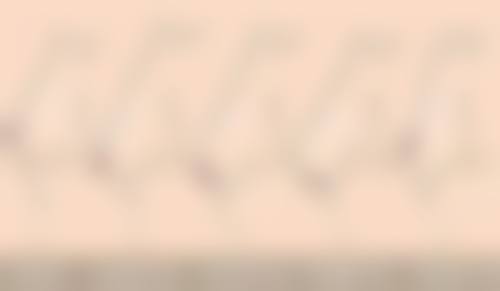 贞美卓玥美白针:东方美学的内调外养之法