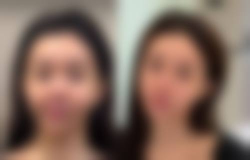 丽丝塔整形外科医院技术好不好?