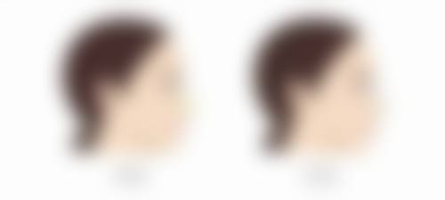 本真美美白针:成分透明的安心之选