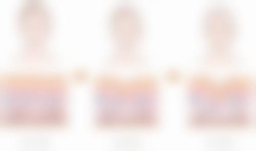 唇部改薄手术如何进行