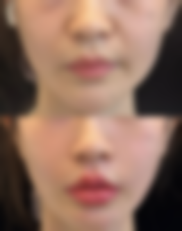 上海爱美整形医院口碑如何?