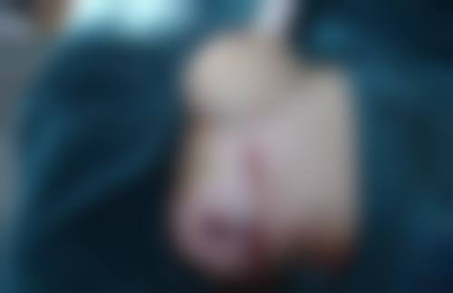 总结——mijak整形外科怎么样?