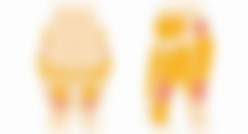 软组织损伤的风险会有哪些表现