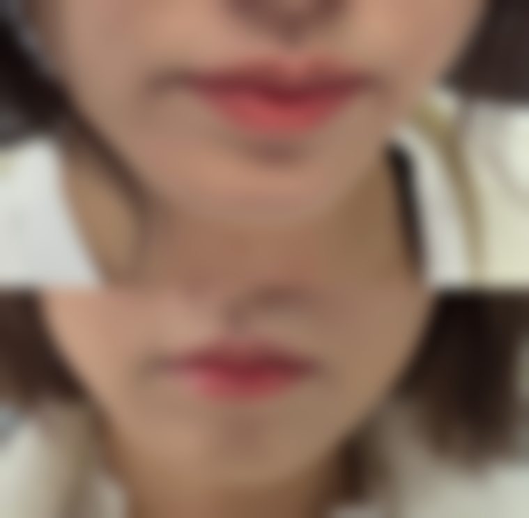 襄阳悦美整形营业时间