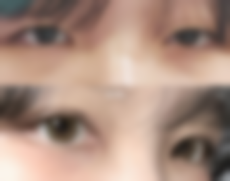 连云港媚眼整形营业时间