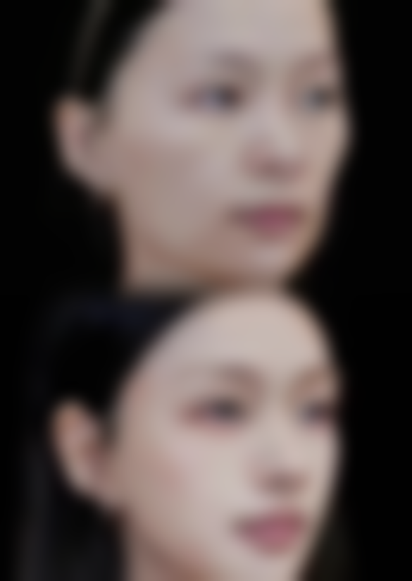 襄阳悦美整形口碑如何?