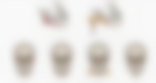 自体脂肪移植丰太阳穴