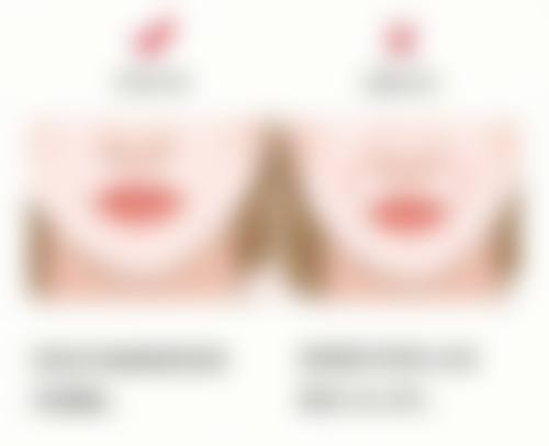 广东惠州瑞芙臣美容医院医院技术好不好?