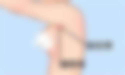 郑州圣蓝医疗美容医院口碑如何？