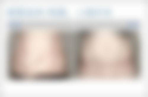 韩国iz皮肤科口碑如何？