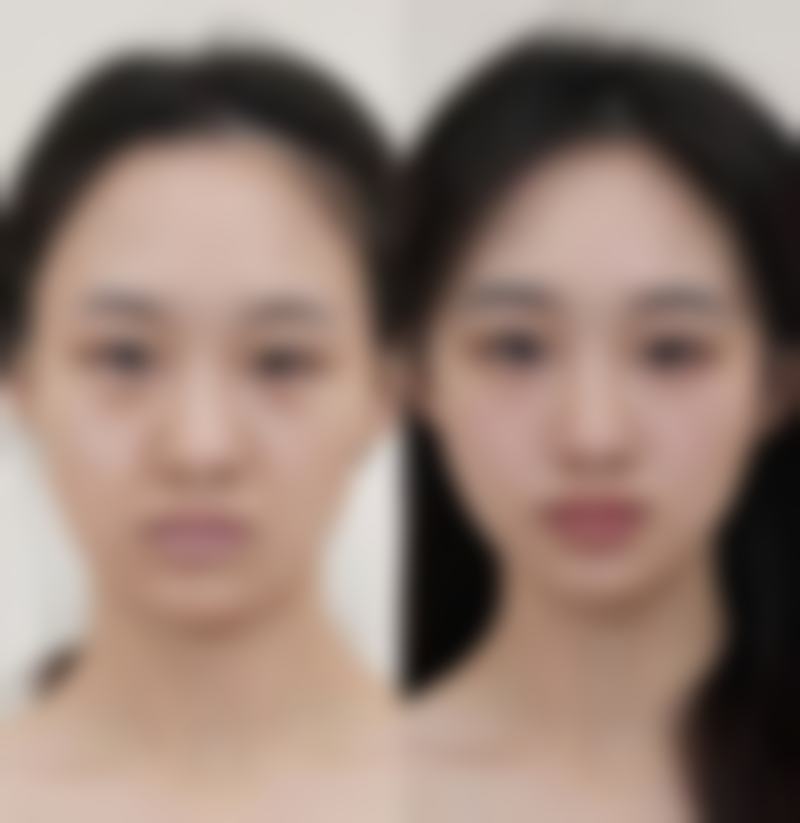 广州云云整形医院收费标准参考