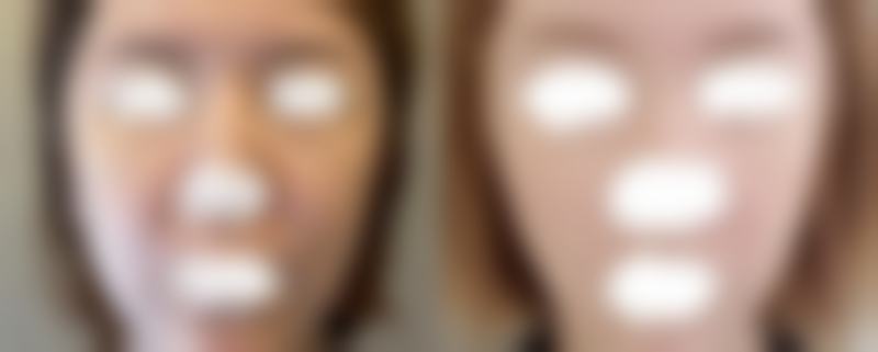 总结——郑州圣蓝医疗美容医院怎么样？