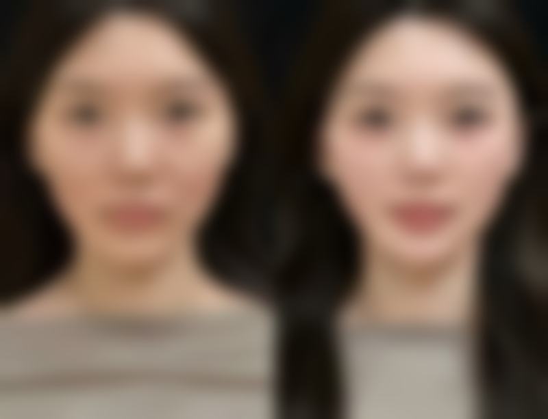 总结——韩国雅阁ARC整形外科医院怎么样？