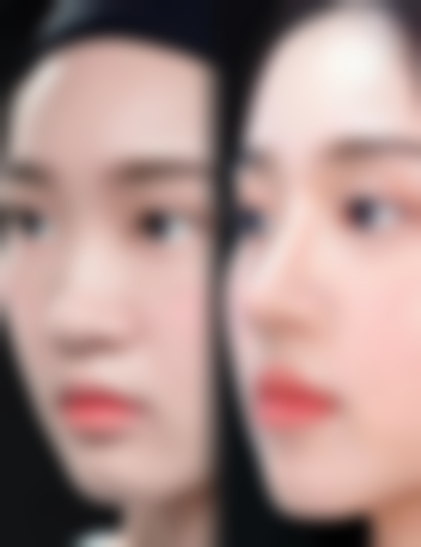 北京朝阳医院整形外科地址