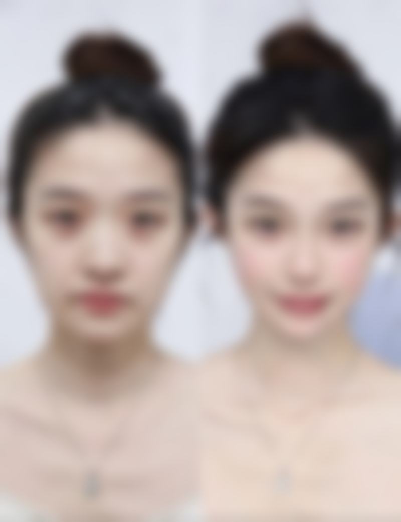 乐至兰妍整形医院硬件设备精良!