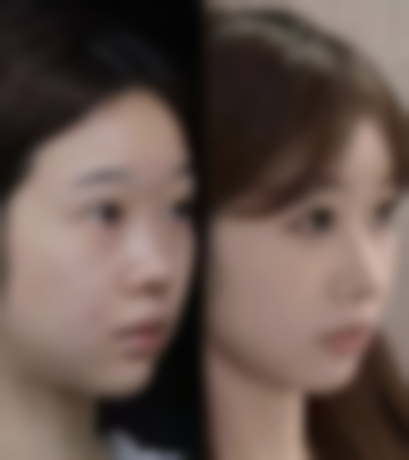 呼和浩特伊思医疗美容医院医院技术好不好？