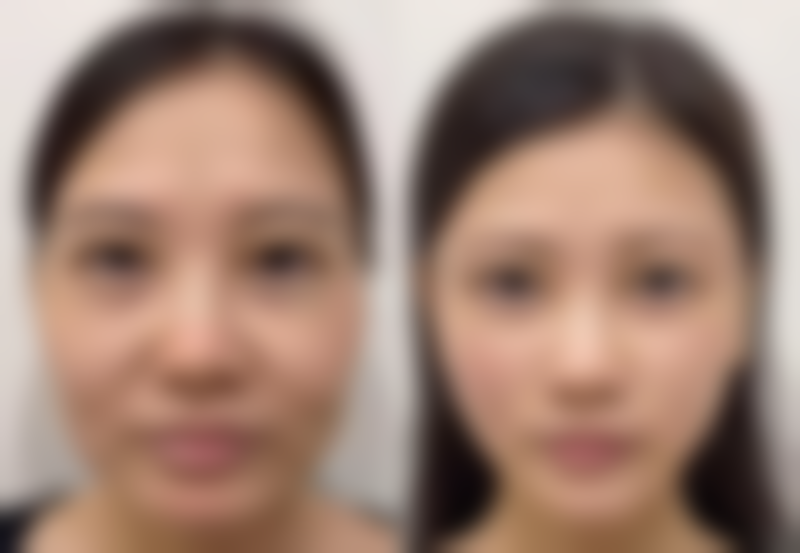 内江瑞美医疗美容门诊部收费标准参考