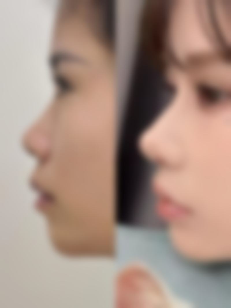 烟台瑞雅韩整形医院硬件设备精良！