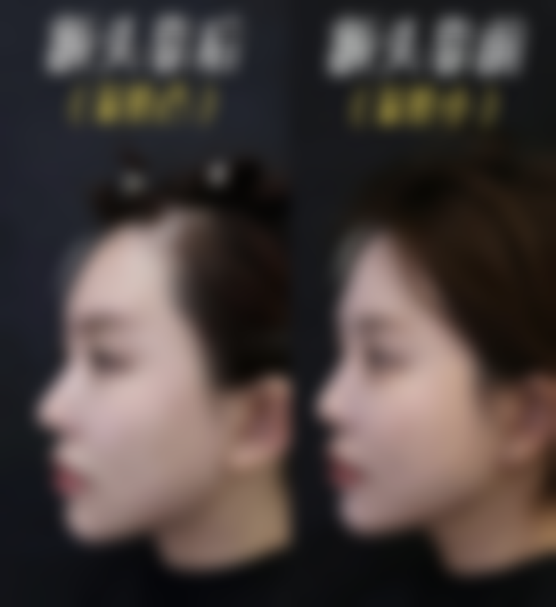 郑州阳光医院整形医院技术好不好？