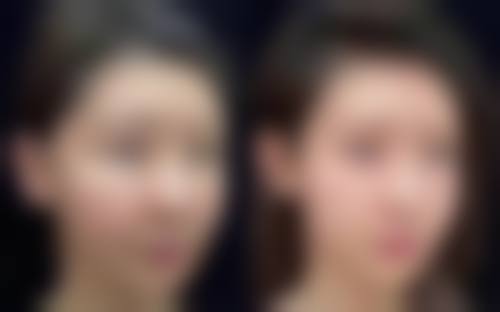 西安肤康皮肤病医院口碑如何？