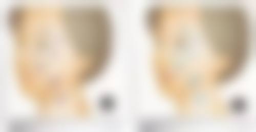 不剃发植发的特别之处