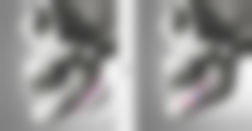 毛囊种植的过程