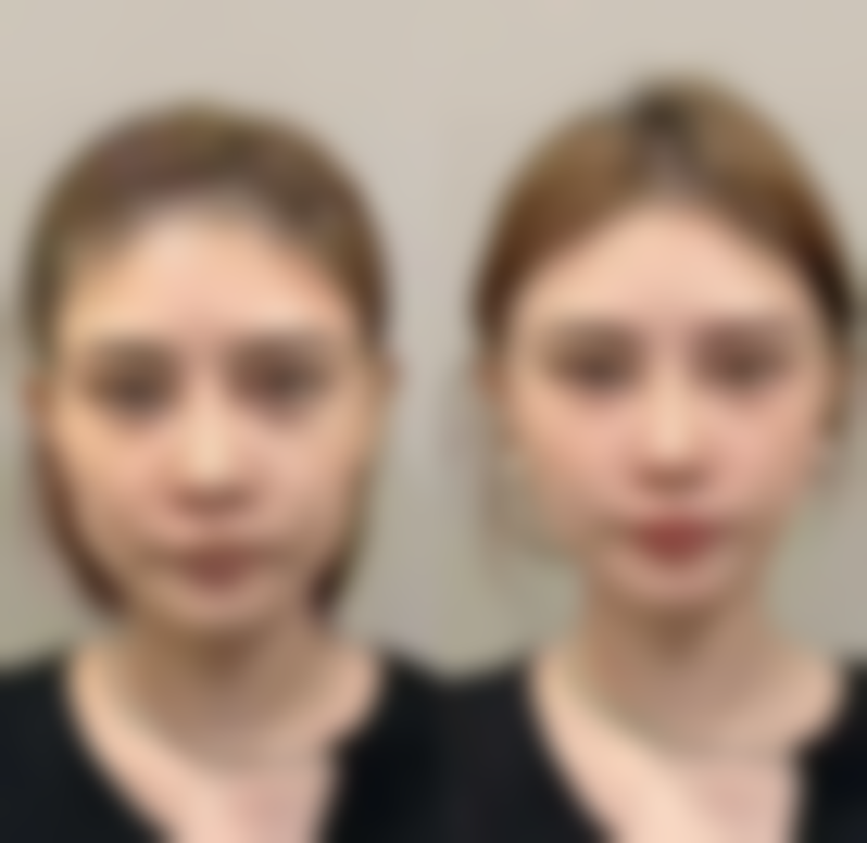 恩施华美医疗美容门诊部医院技术好不好？