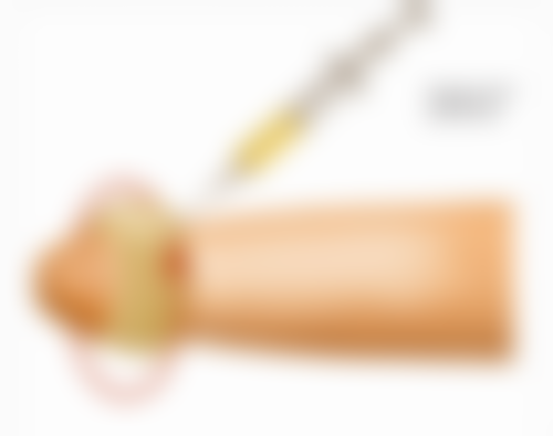 美白针注射的注意事项