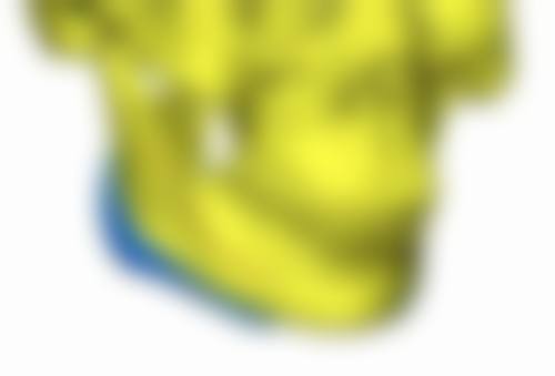 一次除皱针能维持多久受个体差异影响