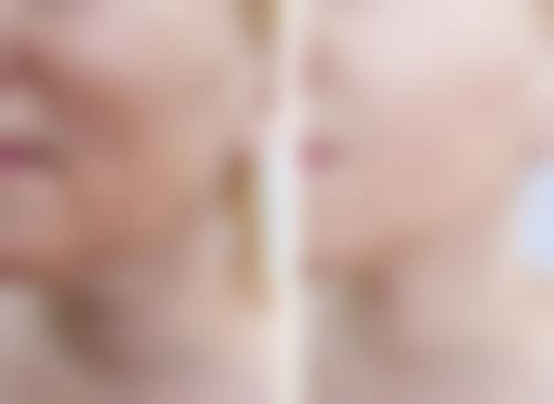 毕节超英医疗美容诊所口碑如何?