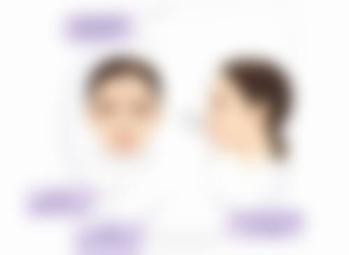 下颚前突如何矫正？多种方法任你选，注意事项和选法也需知晓