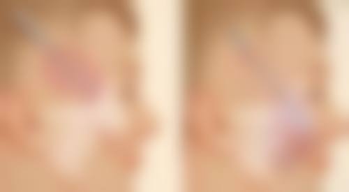 深圳私慕医疗美容门诊部口碑如何?