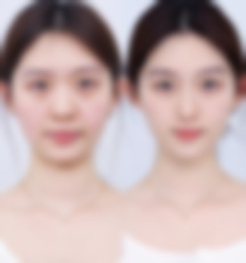 整容可以整嘴唇吗，选择医生和机构要注意什么