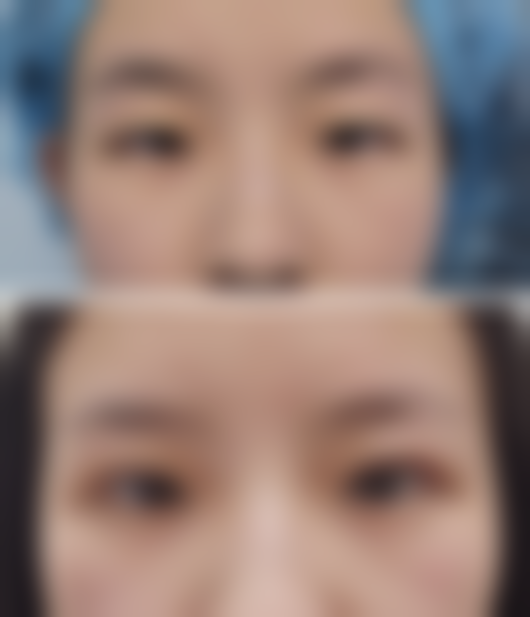 抽脂手术有危险吗？有！但选对机构做好护理等可降低手术风险