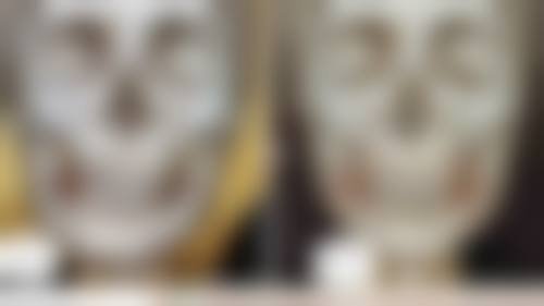 玻尿酸注射隆鼻的风险及注意事项