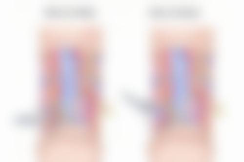 种植一次头发要多少与术后护理