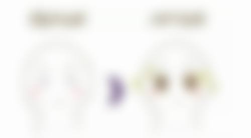 玻尿酸注射隆鼻成效的维持时间