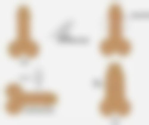 不同品牌玻尿酸注射隆鼻成效差异