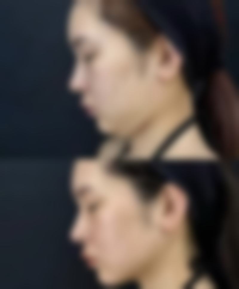 东莞艾莱美医疗美容收费标准参考