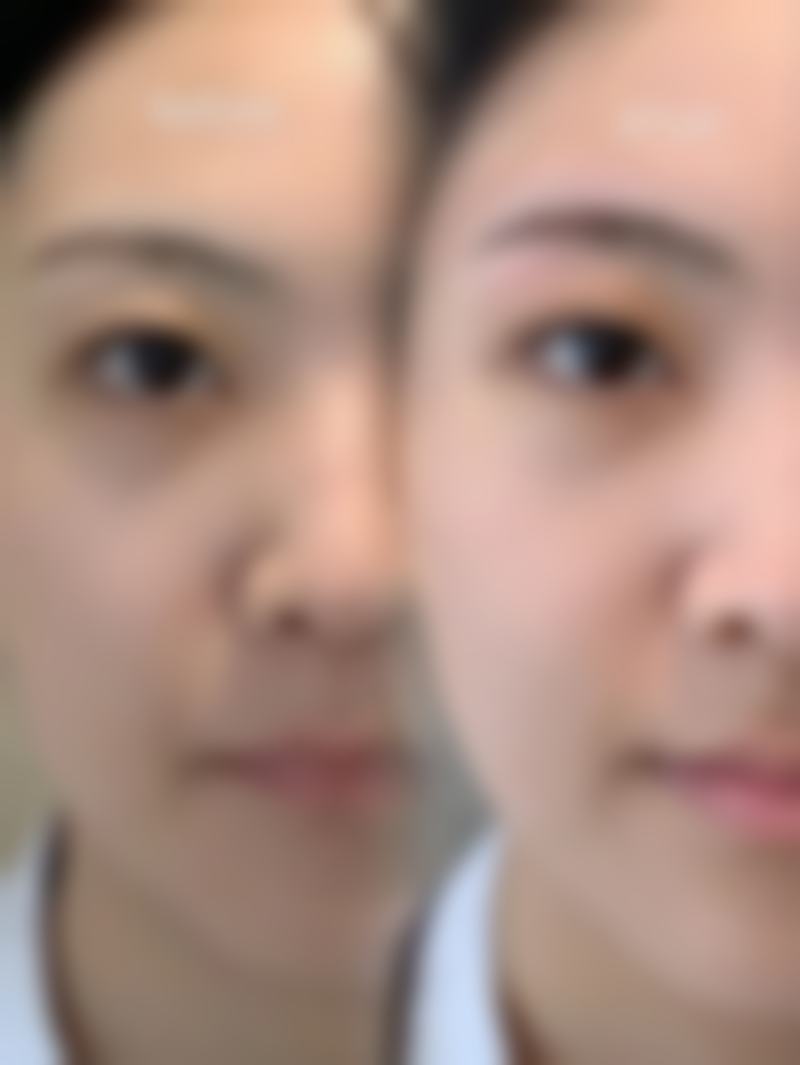 女人阴唇缩小是什么原因？或是年龄、分娩、遗传、激素等因素在“作怪”