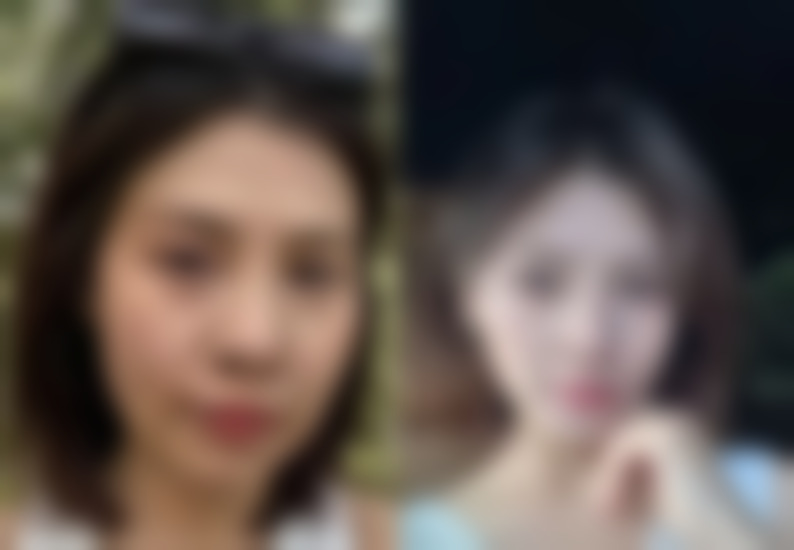 总结——东莞艾莱美医疗美容怎么样？