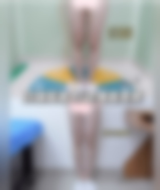 北京纯脂医疗美容门诊部大腿吸脂蜕变咋样？冯斌医生助我告别粗腿自信穿短裙！ 